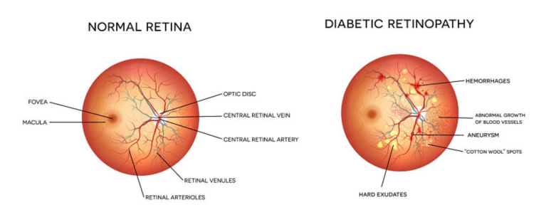 Screen Shot 2019-11-04 at 11.51.45 AM.png